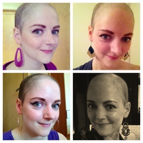 Hair regrowth after cancer and why I ditched the wigs Breast